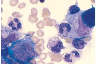 Jetzt das Immunsystem für den Herbst und Winter stärken