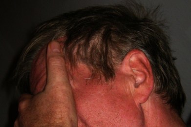 Vegetatives Nervensystem naturheilkundlich behandeln